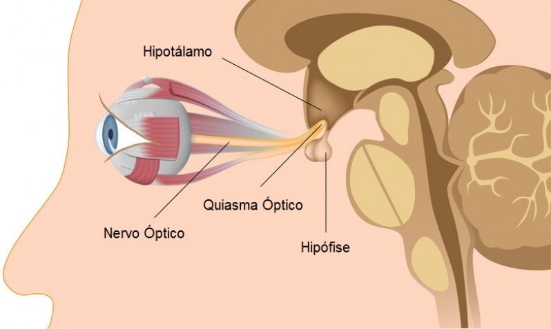 Exame de Acuidade Visual Quanto Custa Água Funda - Exame de Angiofluoresceinografia