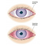 centro médico oftalmológico em são paulo preço Capão Redondo