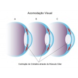 cirurgia de calázio em Higienópolis