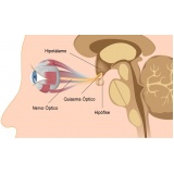 exame de acuidade visual quanto custa Cidade Jardim