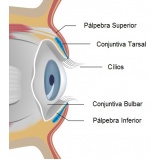 tratamento astigmatismo Pedreira