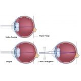 tratamento para ametropia Jardim Bonfiglioli