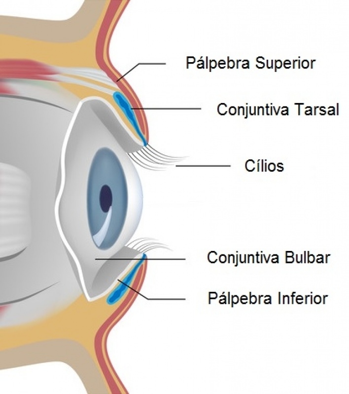 Tratamento Astigmatismo Glicério - Tratamento para Glaucoma