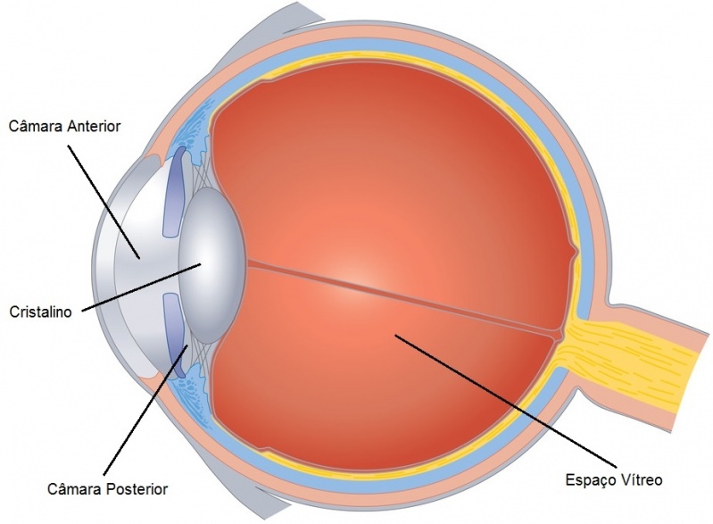 Tratamento de Miopia Alto da Lapa - Tratamento para Glaucoma