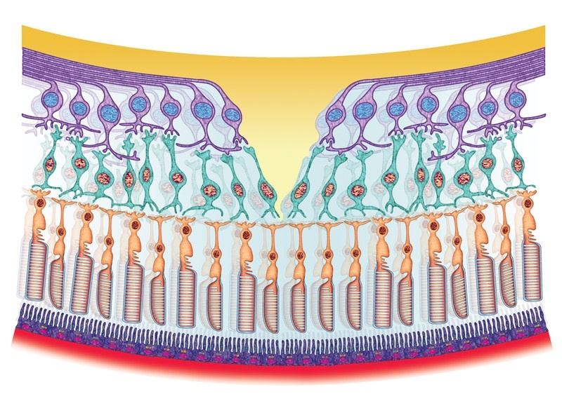 Tratamento Doenças Oculares Jardim América - Tratamento para Ametropia